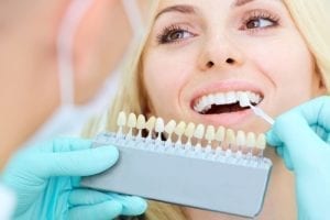 take care of porcelain veneers in Suffolk Virginia