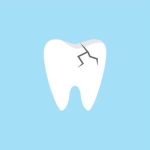 Tooth Fracture FAQs